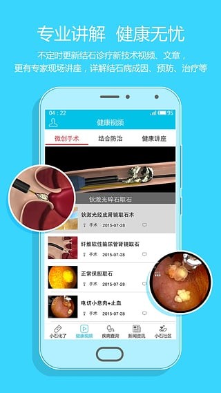 小石化了安卓版 V1.0.4
